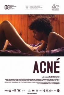 Угри / Acne (2008)